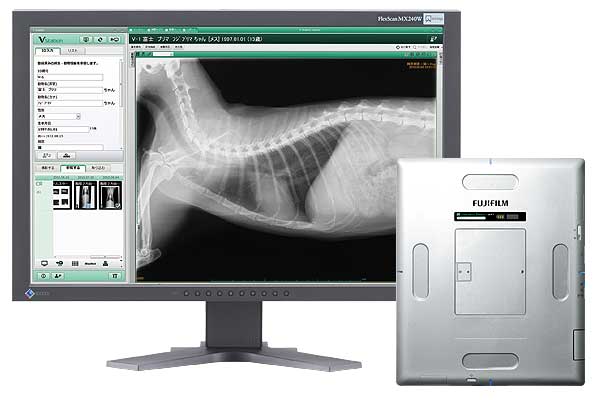 デジタル画像診断システム（DR）